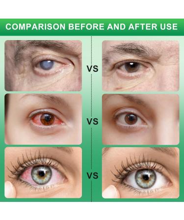 Optivipro Presbyopia Eye Drops | Vision Recovery & Dry Eye Relief | Comprehensive Eye Care (10pcs x 0.7ml) - International Shipping Available - Buy Online on GoSupps.com