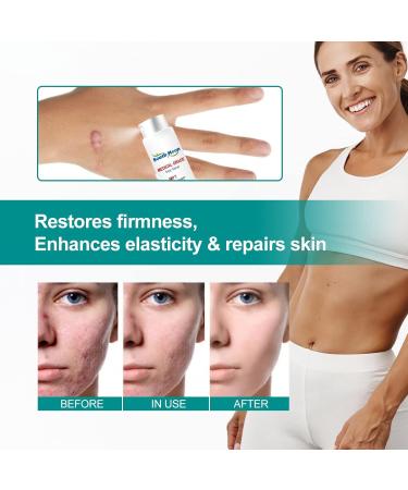 Scar Removal Spray- Advanced Formula for All Types of Scars - 2PCS - Buy Online on GoSupps.com