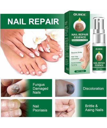 FASSME Nail Repair Essence toenail solution nail repair nursing solution of gray nails safe and effective repair discolored damaged nails 10ml - Buy Online on GoSupps.com