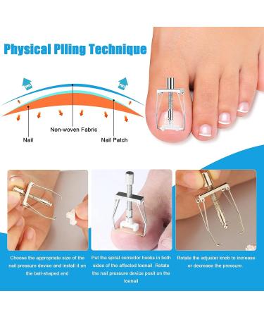 Ingrown Toenail Removal Kit - Professional Pedicure Tool Set for Seniors, Includes Clippers, Corrector Patch, and Strips for Thick Toe Nails - Pain Relief Treatment - Buy Online on GoSupps.com
