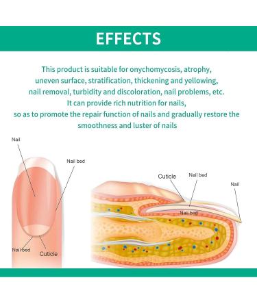 Nail Repair Essence for Fingernail & Toenail Fungus - Repairs, Protects, and Strengthens Nails (3 Pcs) - Buy Online on GoSupps.com