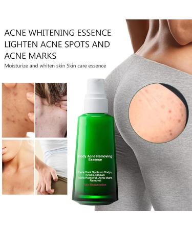 Brightening Facial Essence for Pale Skin | Vitamin-Enriched Aluminum Formula | Reduces Dark Circles & Restores Elasticity - Buy Online on GoSupps.com