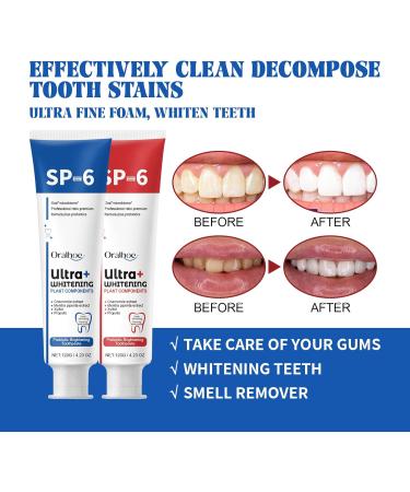 Probiotic Whitening Toothpaste Sp 6 Toothpaste Sp-6 Anti-Caries Toothpaste Sp-6 Deep Cleaning Toothpaste Breath Freshening Toothpaste (Blue 2pcs) - Buy Online on GoSupps.com