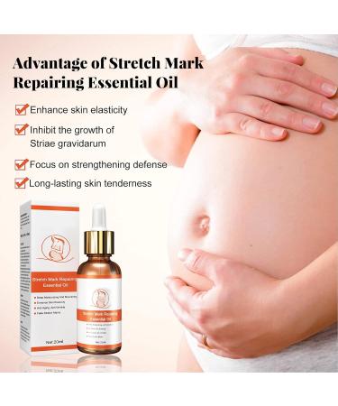 Stretch Marks Repair Essential Oil | Improve Skin Elasticity for Pregnancy Care Shop Now! - Buy Online on GoSupps.com