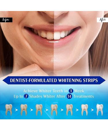 Teeth Whitening Teeth Whitening Strips (15 units (Pack of 1)) - Buy Online on GoSupps.com