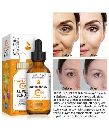 20% Vitamin C Serum for Face with Hyaluronic Acid - Anti-Aging Facial Serum for Men & Women Fades Dark Spots Boosts Collagen Hydrates & Plumps Skin - 1 Fl Oz - Buy Online on GoSupps.com