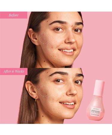 Glow Recipe Holiday Ornament & Travel Size Niacinamide Dew Drops - Hydrating Serum & Highlighter with Hyaluronic Acid - Lightweight Facial Serum (15 ml) for Glowing Skin - Buy Online on GoSupps.com