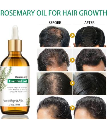 Rosemary Oil for Hair Hair Regrowth Serum Relieve Dry Damaged Hair to Target Hair Loss Rosemary Hair Serum for Hair Rapid Growth and Thickening Trengthen Hair Roots - Buy Online on GoSupps.com