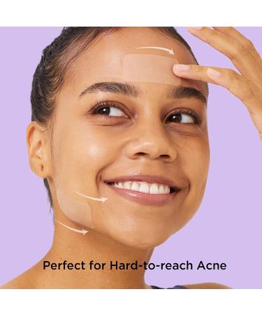 Avarelle Pimple Patches (16 Count) Hydrocolloid Acne Cover with Tea Tree & Calendula - Vegan & Cruelty-Free | Zit & Blemish Treatment - Buy Online on GoSupps.com
