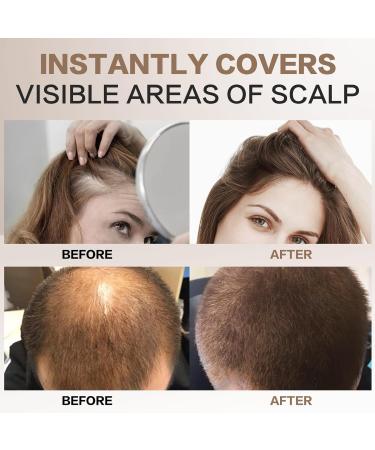 Approach Powder Blonde 4g Hair Concealer | Waterproof Hairline Powder for Thinning Hair - Instant Coverage for Men & Women - Buy Online on GoSupps.com