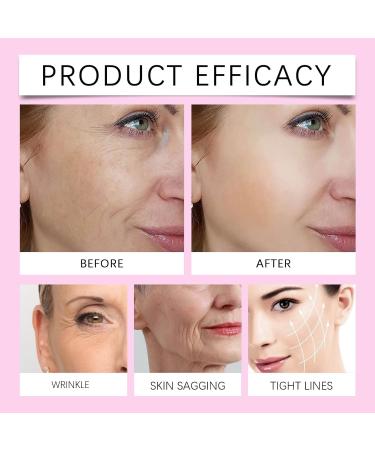 Rubu22a Wrinkle Plasters for Face 144 Pcs AntiWrinkle Plasters AntiWrinkle Plasters for Forehead Eyes Smiling Line Face Lifting Tape Night Use 1 Pcs 1 Pack - Buy Online on GoSupps.com