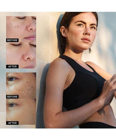 AOBBIY Hyperpigmentation Treatment â€“ Dark Spot Remover for Face & Body, Niacinamide Serum for Melasma, Sun Spots, 1.01 Fl Oz - Buy Online on GoSupps.com