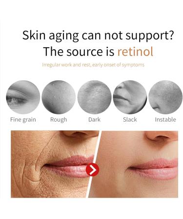 Dragons Blood Easy Cream Dragon Blood Cream Retinol Face Cream Retinol Placenta Dragon Blood Cream Retinol Placenta Royal Dragon Blood Cream Dragon Blood Serum Face Moisturizer - Buy Online on GoSupps.com