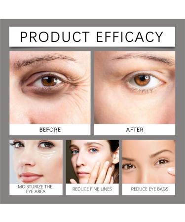futiu Eye Cream - Improves Eye Area Firmness Relieves Dry Lines Easy Massage Application Gentle Formula(5pcs) - Buy Online on GoSupps.com