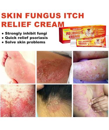  MagiSel Anti-itch ointment skin cream soothing skin cream for itching and psoriasis natural care formula cares for and soothes the skin suitable for skincare - Buy Online on GoSupps.com