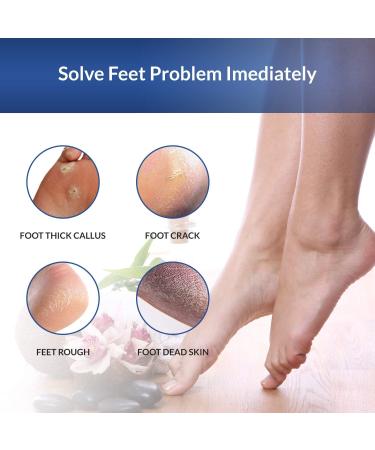 COMGO Metal Pedicure Foot File Callus Remover - Double-Sided Scrubber for Dead Skin - Professional Quality (1 Piece, Black) - Buy Online on GoSupps.com
