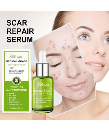 Advanced Scar Repair Serum - Medical Grade Spray for Acne, Surgical, Stretch Marks & Burns - Skin Repair Treatment (3PC) - Buy Online on GoSupps.com