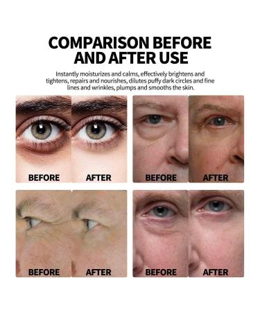 Men's Eye Cream & Serum Set | Hydrating Vitality Roller for Dark Circles | 2pcs - Buy Online on GoSupps.com