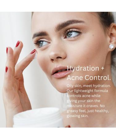 AWARD-WINNING Acne Cream - 4X STRONGER 11X FASTER! Patented technology features Organic Salicylic Acid. Target Blackheads & Blemishes - 100ml - Buy Online on GoSupps.com