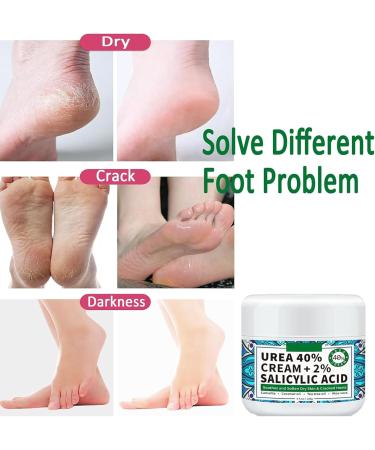 Urea 42% Foot Cream Urea Cream 40 Percent for Feet Urea Foot Cream Foot Cream for Cracked Heels and Dry Skin - Cracked Heel Repair Cream Foot Moisturiser Strength for Hand Foot and Body Care - Buy Online on GoSupps.com