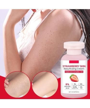  Fmzrbnih Strawberry Skin Lotion 100ml Body Scrub Strawberry Skin Cream For Legs - Softening Moisturizing Body Lotion For Chicken Neck Arm Legs Face Travel - Buy Online on GoSupps.com