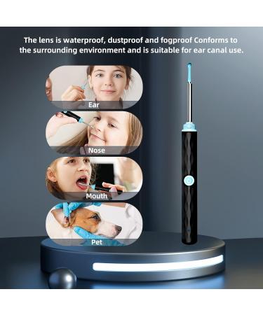 AVM Ear Wax Removal Camera HD 1296p - Wireless Ear Cleaning Tool with 8 Earwax Cleaner Kit for Kids Adults & Pets - Compatible with iPhone & Android - YY10ERB - Buy Online on GoSupps.com
