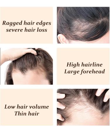 Hairline Shading Powder - Instantly Root Touch Up - Waterproof Hair Powder - Temporary Conceal Thin Grey Hair Full Coverage - Beautify Modify Forehead Natural Looking Thicken Cover Up (DARK BROWN) - Buy Online on GoSupps.com