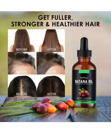 Batana Hair Oil 60 ml Hair Thickness Repairs Damaged Hair Strengthens and Nourishes Damaged Hair Organic Natural Batana Oil - Buy Online on GoSupps.com