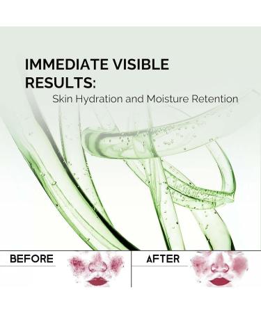 100% Pure Plant-Derived Squalane Serum | Hydrating & Rejuvenating Anti-Aging Formula | 1 Fl. Oz - Shop Now - Buy Online on GoSupps.com
