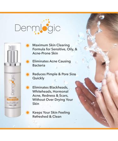 Maximum Strength Benzoyl Peroxide 10% Face & Body Wash for Acne - Clears Pores on Contact, Soothes Skin - 10 oz - Buy Online on GoSupps.com