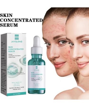 Serum Anti-Aging Facial Skin Regeneration & Repair Essence Facial Care Men and Women Moisturizing Essence Reduce Scar Fine Lines Wrinkles Acne Spots - Buy Online on GoSupps.com
