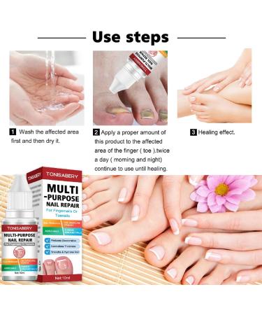 Fungal Nail Treatment Nail Fungus Treatment for Toenail Ingrown Toenail Treatment Toe Nail Fungal Treatment Fungal Nail Treatment for Toenails Extra Strong Nail Repair Treatment Repairing Broken Nail - Buy Online on GoSupps.com