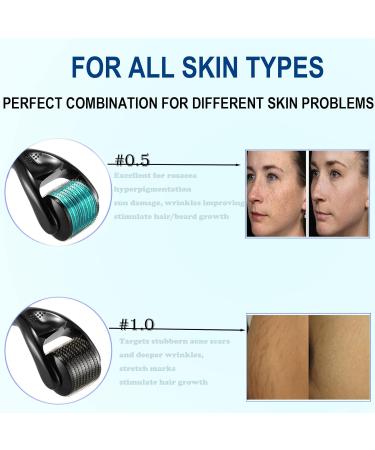 Derma Roller 0.5 & 1.0 Microneedling Set for Face, Body, Hair, and Beard Growth 540 Titanium Micro Needles Roller Kit for Home Use with Storage Case Cosmetic Beauty Instrument 2 Pack - Buy Online on GoSupps.com