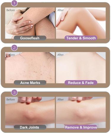 Niacinamide Body Scrub - Flower Fragrance Body Scrub Exfoliator - Niacinamide Exfoliating Body Scrub - Deep Cleansing Refine Pore Moisture Hydrating - Improve Dullness Restore Smooth Skin Elasticity - Buy Online on GoSupps.com