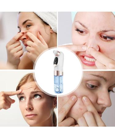 Fiakup Electric Extractor Electric Facial Pore Cleaner - Adjustable Rechargeable Remover with 6 Suction for Skincare for Women and Men - Buy Online on GoSupps.com