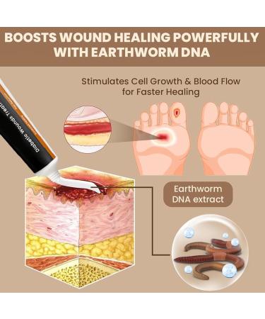 Foot Cream Soothing Natural Moisturizing 30gCracked Heels Repair Lotion For Daily Use Women Men Adults Athletes Cracked Sensitive Heels - Buy Online on GoSupps.com