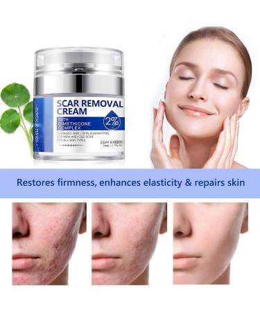 50ml Skin Repair Stretch Mark & Scar Removal Cream - Effective Surgery, Injury & C-Section Scar Lightening Treatment & Toenail Clippers Removal Solution - Buy Online on GoSupps.com