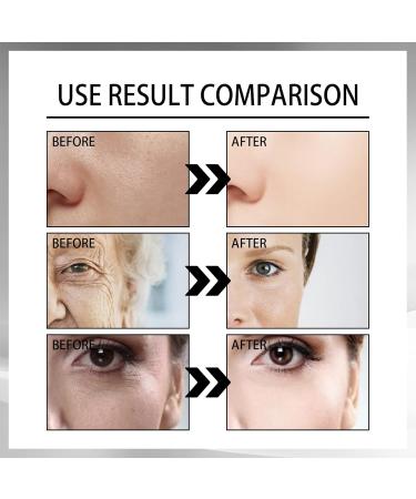 Facial serum facial cream for rice antiaging facial cream for all skin types improves rough skin makes elasticity Black Rice Serum Cream Set - Buy Online on GoSupps.com