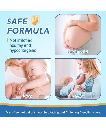 LONNIELONLI Silicone Scar Sheets - 2 Pack 1.6x60 Roll - Reusable Professional Scar Removal Tape for C-Section, Surgery, Burn, Keloid, Acne - Buy Online on GoSupps.com