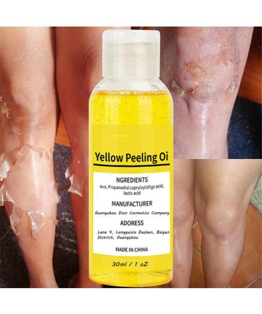 Super Strength Yellow Peeling Oil for Dark Skin - 30/50ml Exfoliating Lightening Treatment - Extra Strength for All Skin Types - Buy Online on GoSupps.com