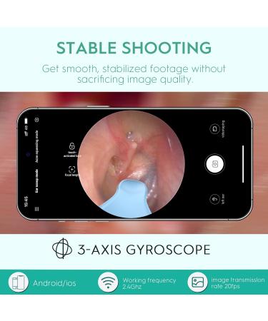 Oxbird 1080P Wireless Ear Wax Removal Kit with Camera - Smart Ear Cleaner for iPhone, iPad & Android - Black - Buy Online on GoSupps.com