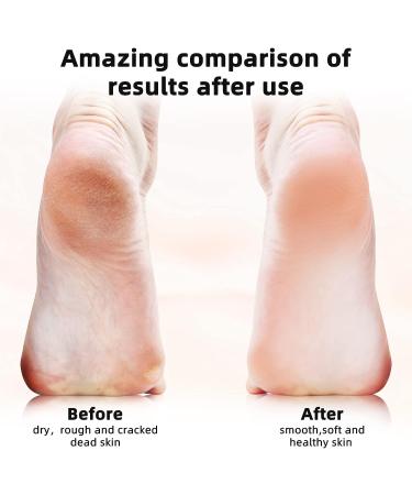 Electric Callus Remover for Feet - Professional Pedicure Tool Kit for Cracked Dead Dry Skin - Buy Online on GoSupps.com