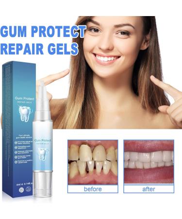 Gum Shield Therapy Gel Dentizen Gum Therapy Gel Gum Shield Therapy Gel Teeth Whitening Pen for Sensitive Teeth (3Pcs) - Buy Online on GoSupps.com