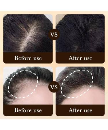 S rum r g n rant anti-chute de cheveux 2 x 20 ml avec rouleau cheveux - Renforce les racines des cheveux r duit la chute des cheveux favorise une nouvelle croissance des cheveux pour des cheveux - Buy Online on GoSupps.com