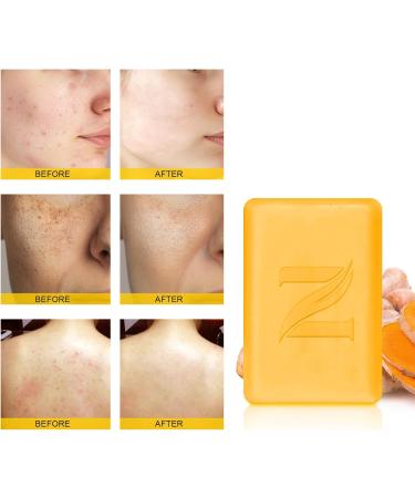  NEUTRIHERBS Neutriherbs Turmeric Facial Body Soap (150g.1 bar) Vitamin C Whitening Bar Soap for Acne Irregular Complexion Natural Soap Cleansing - Buy Online on GoSupps.com