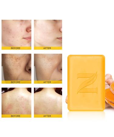 Neutriherbs Turmeric Soap Bar for Face & Body | Brightening Vitamin C for Acne & Uneven Skin Tone - 5.29 oz - Buy Online on GoSupps.com