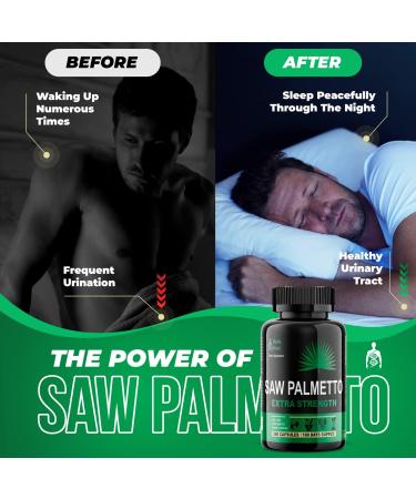 Saw Palmetto DHT Blocker Supplement - Prostate Health Support, Hair Loss Prevention, Hair Growth Vitamins - Organic Beta Sitosterol 500mg - Men & Women - Buy Online on GoSupps.com
