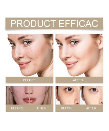 Niacinamide Serum 10% with 1% Zinc - Anti-Aging Face Serum for All Skin Types | Moisturizing 1FL.OZ - International Shipping Available - Buy Online on GoSupps.com