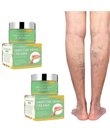 EXQST Varicose Veins Cream CremePure Varicose Veins Leg Cream