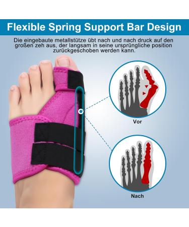 Hallux Valgus Correction Rail - Relief for Large Toe Pain Align Toes Big Toe Protection for Men & Women (Rose Red Left) - Buy Online on GoSupps.com